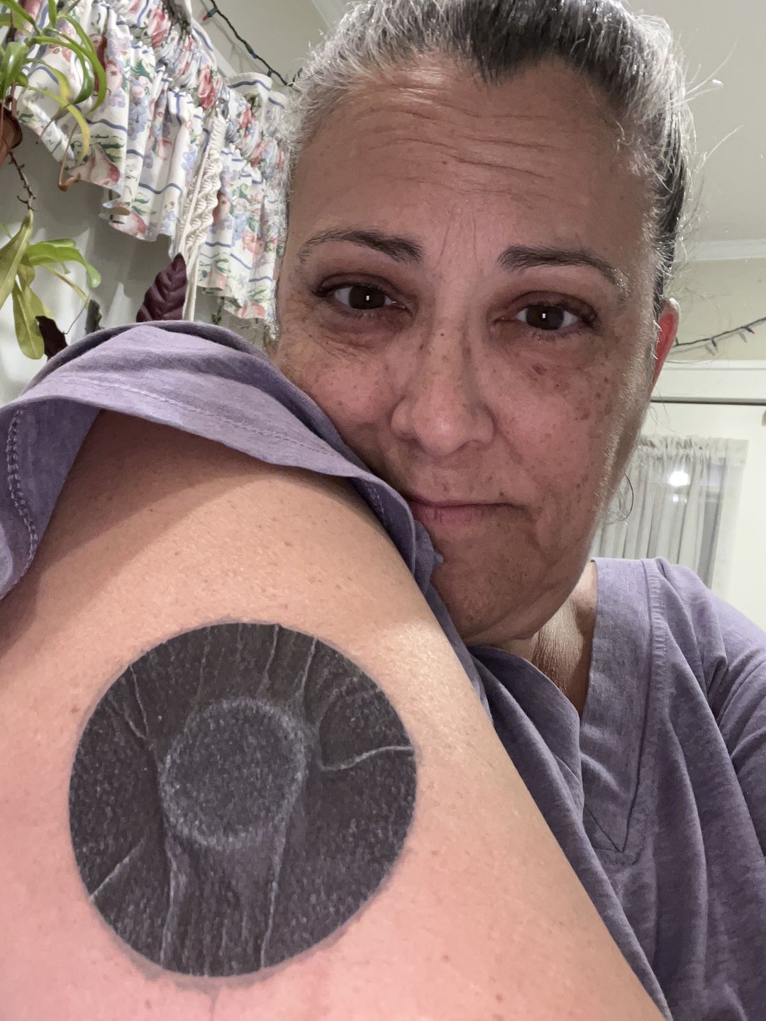 Customer photo review of Skin Grip MAX Freestyle Libre Patches