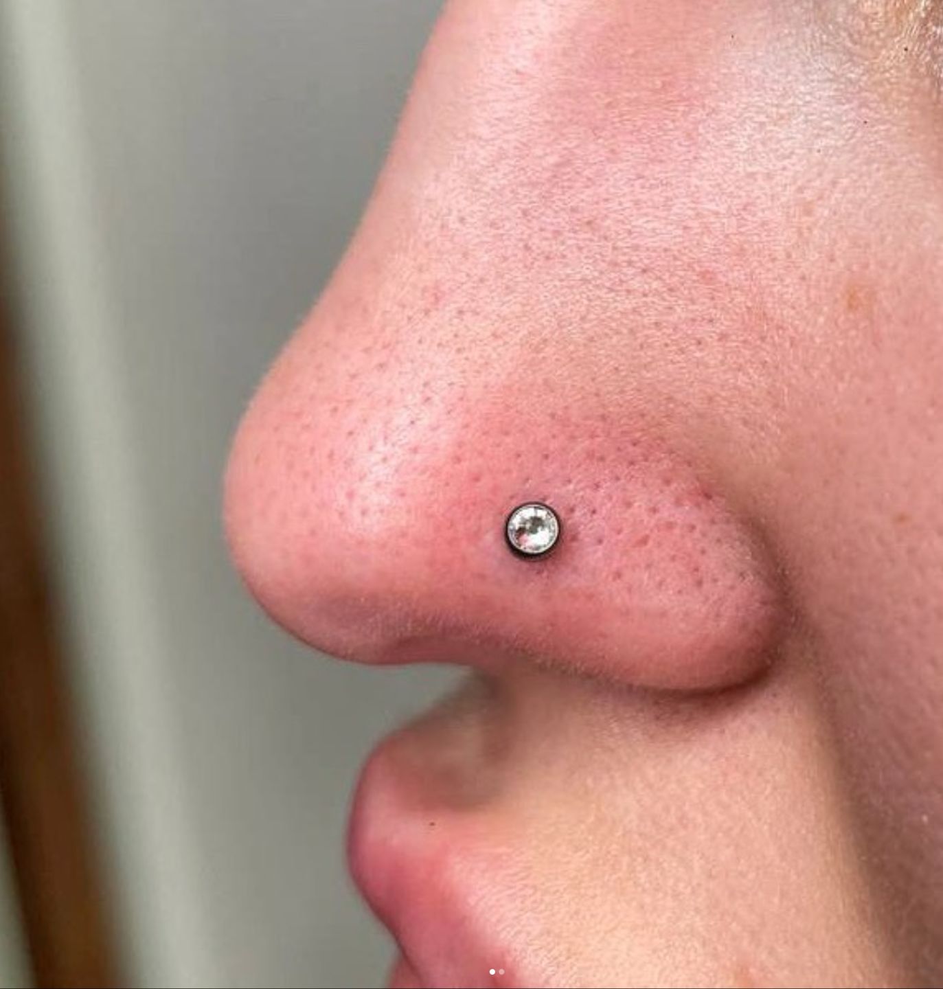 Customer photo review of Piercing Aftercare Swabs