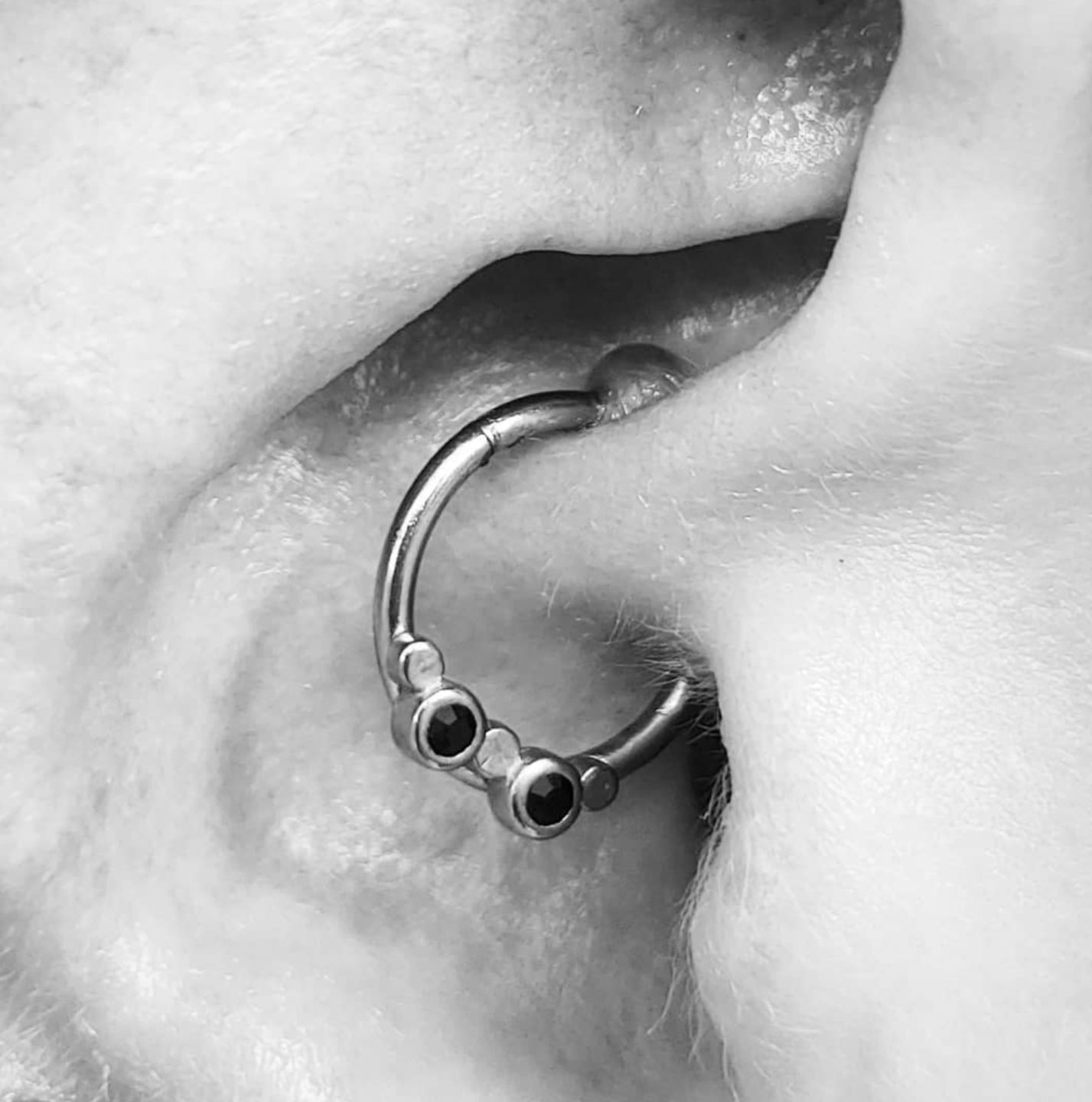 Customer photo review of Piercing Aftercare Swabs