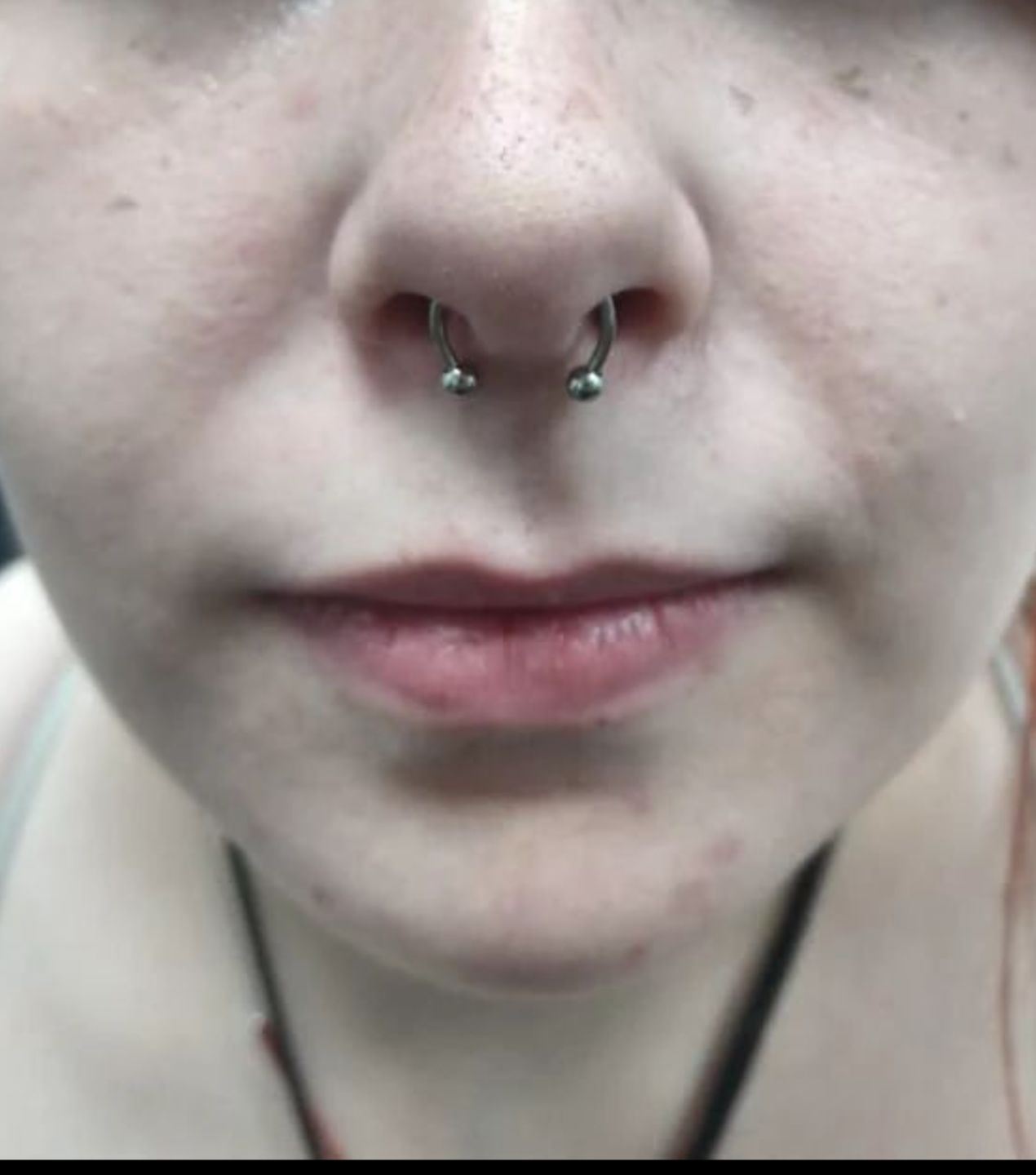Customer photo review of Piercing Aftercare Swabs