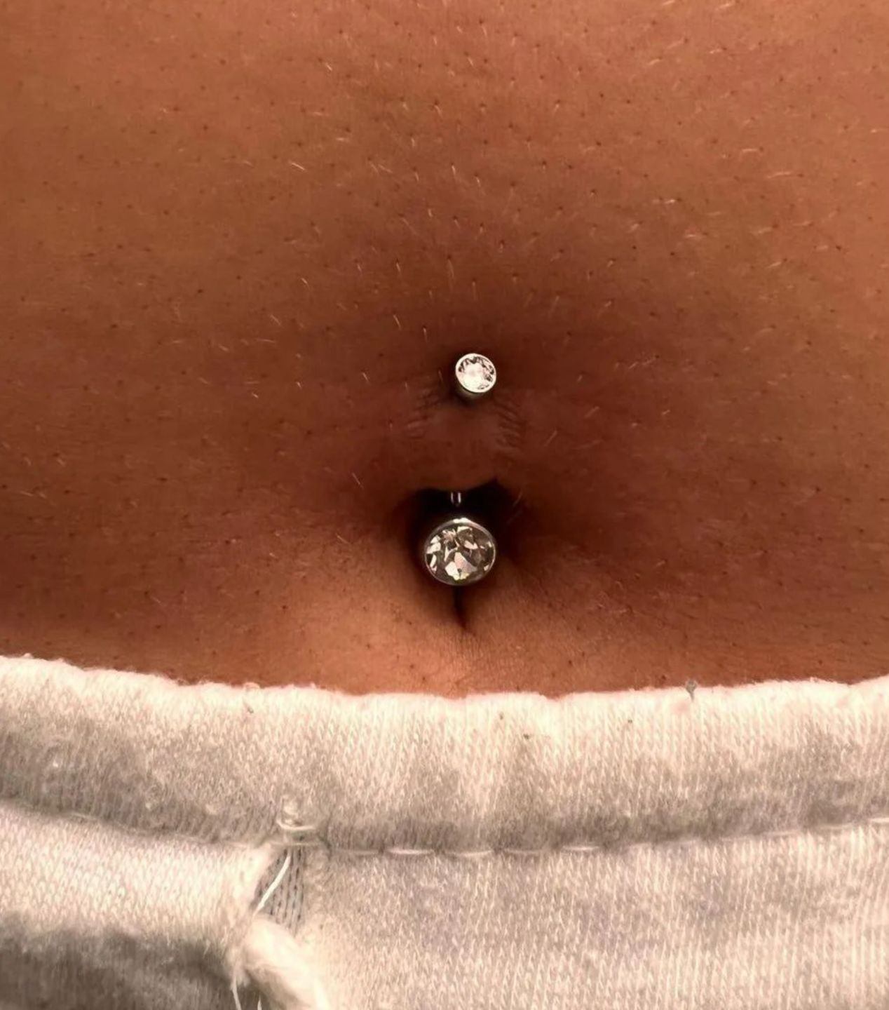 Customer photo review of Piercing Aftercare Swabs