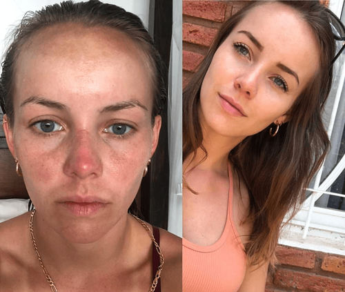 Customer photo review of LuxeSkin™ Anti-Aging Kollagen Pärlkräm