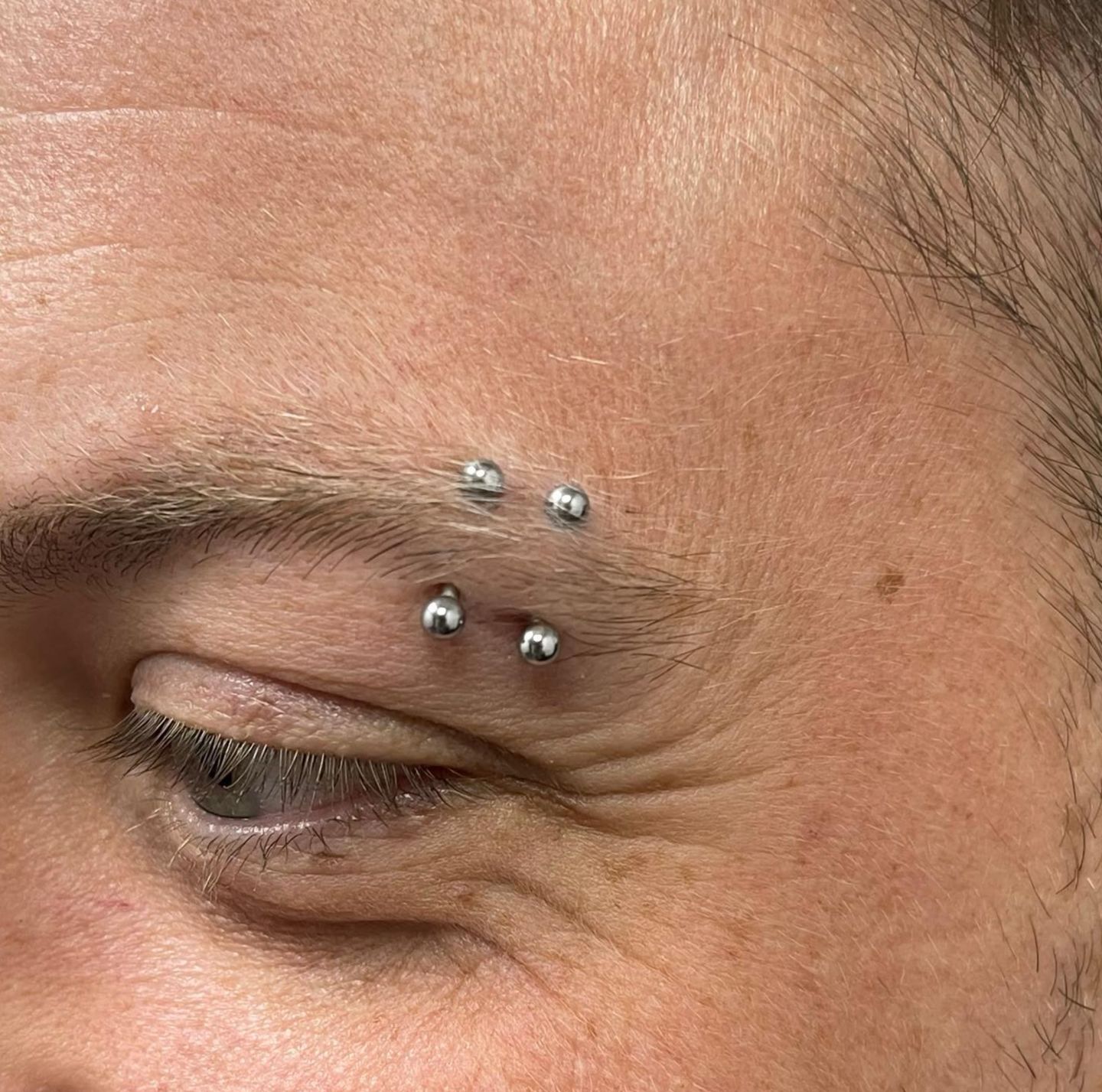 Customer photo review of Piercing Aftercare Swabs