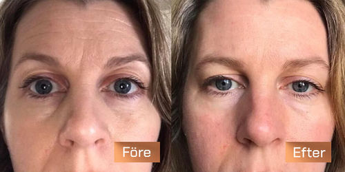 Customer photo review of LuxeSkin™ Anti-Aging Kollagen Pärlkräm
