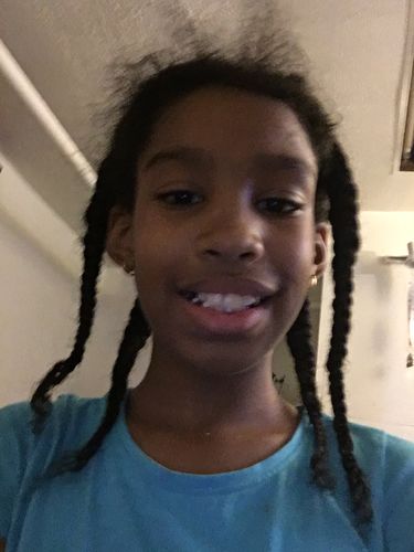 Customer photo review of India’s Secret Ancient Ayurvedic Hair Follicle Elixir (4 sizes)