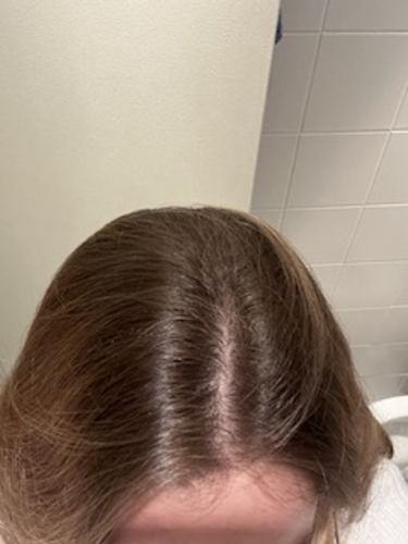Customer photo review of Notre soin éclaircissant pour des cheveux rayonnants en moins de 5 minutes