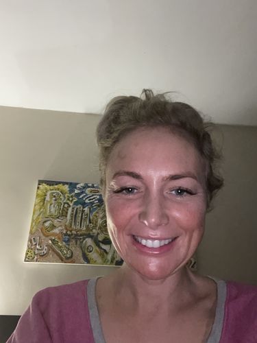 Customer photo review of WrinkleFix: Botox (Existing Customers)