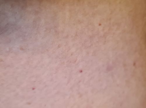 Customer photo review of ערכה טיפולית לעור אטופי ויבש | TOPIC SKIN KIT