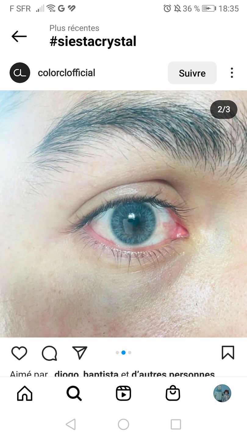 Customer photo review of Siesta Crystal Iris Blue