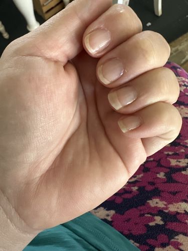 Customer photo review of Rocket Nail Fuel Nail Repair - Clear