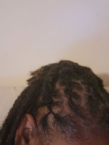 Customer photo review of Hair Oil & Hair Moisturizer Kit