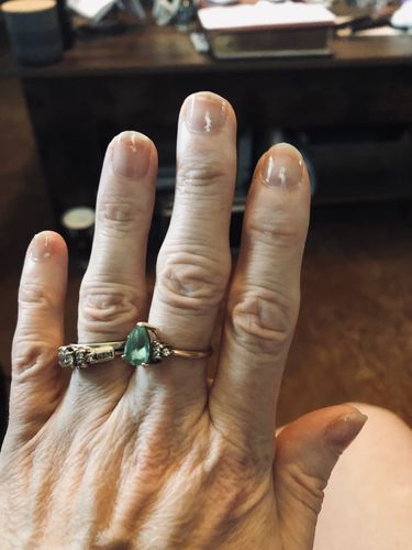 Customer photo review of Route Package Protection