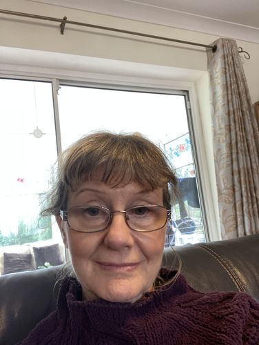 Customer photo review of Brightening Cream