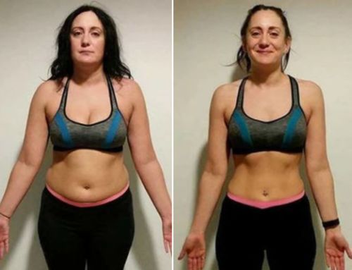 Customer photo review of MYMI CurveBelly Wonder Patch（🔥Limited time discount）