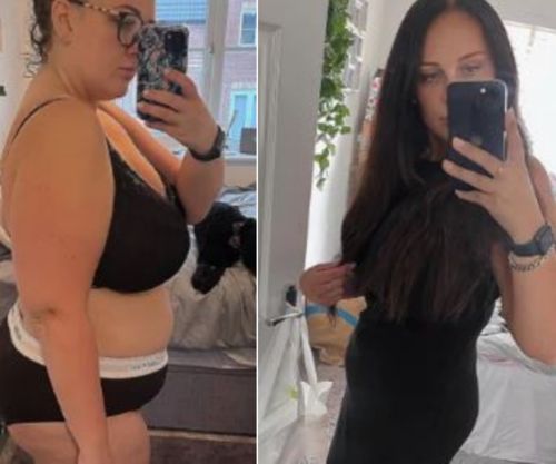 Customer photo review of MYMI CurveBelly Wonder Patch（🔥Limited time discount）