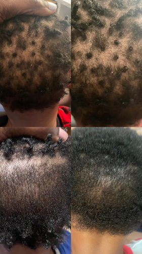 Customer photo review of India’s Secret Ancient Ayurvedic Hair Follicle Elixir (4 sizes)