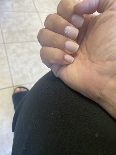 Customer photo review of Rocket Nail Fuel Nail Repair - Clear