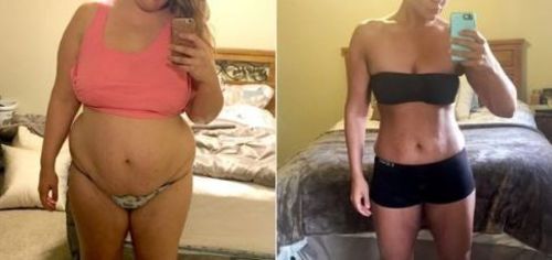 Customer photo review of MYMI CurveBelly Wonder Patch（🔥Limited time discount）
