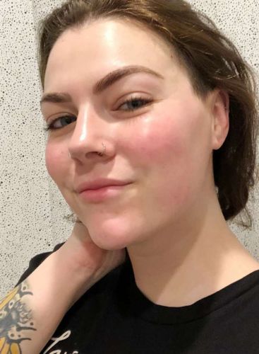 Customer photo review of GloWhite™ Dark-Spot Corrector Cream（🔥Limited time discount）