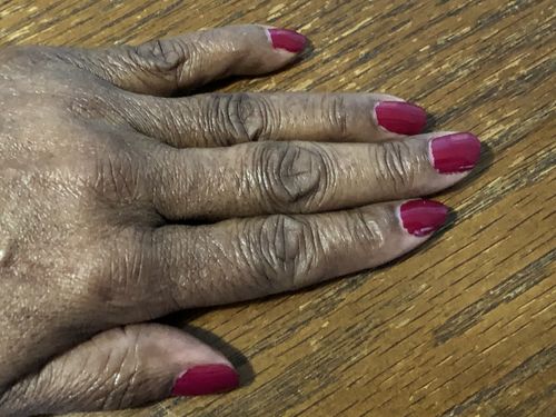 Customer photo review of Route Package Protection