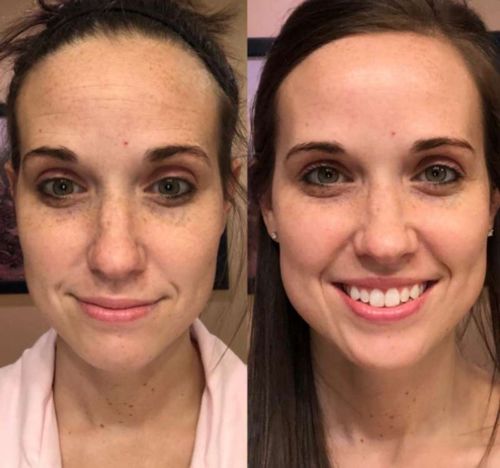 Customer photo review of GloWhite™ Dark-Spot Corrector Cream（🔥Limited time discount）