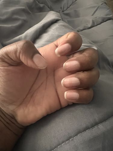 Customer photo review of Rocket Nail Fuel Starter Kit