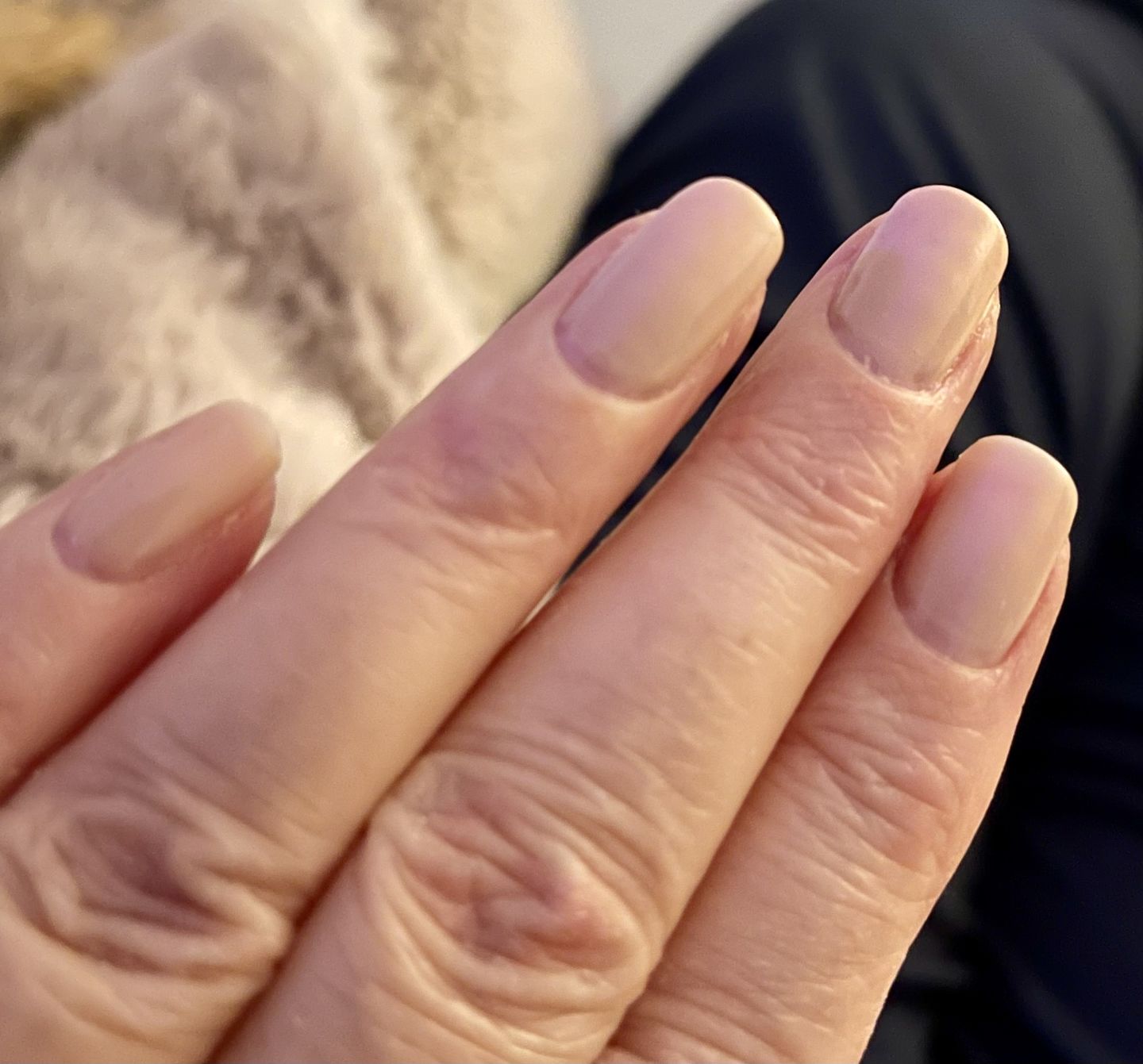 Customer photo review of Semilac Nail Power Therapy 5in1 Recovery Nude Nail Conditioner 7 ml