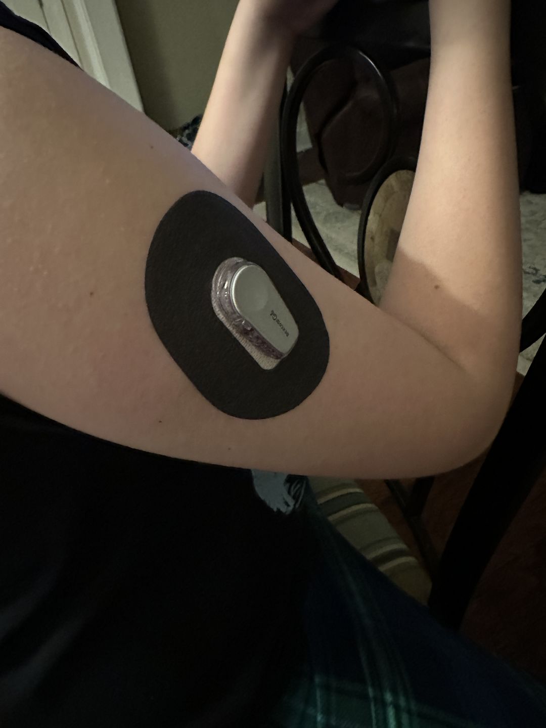 Customer photo review of Skin Grip MAX Dexcom G6 Patches