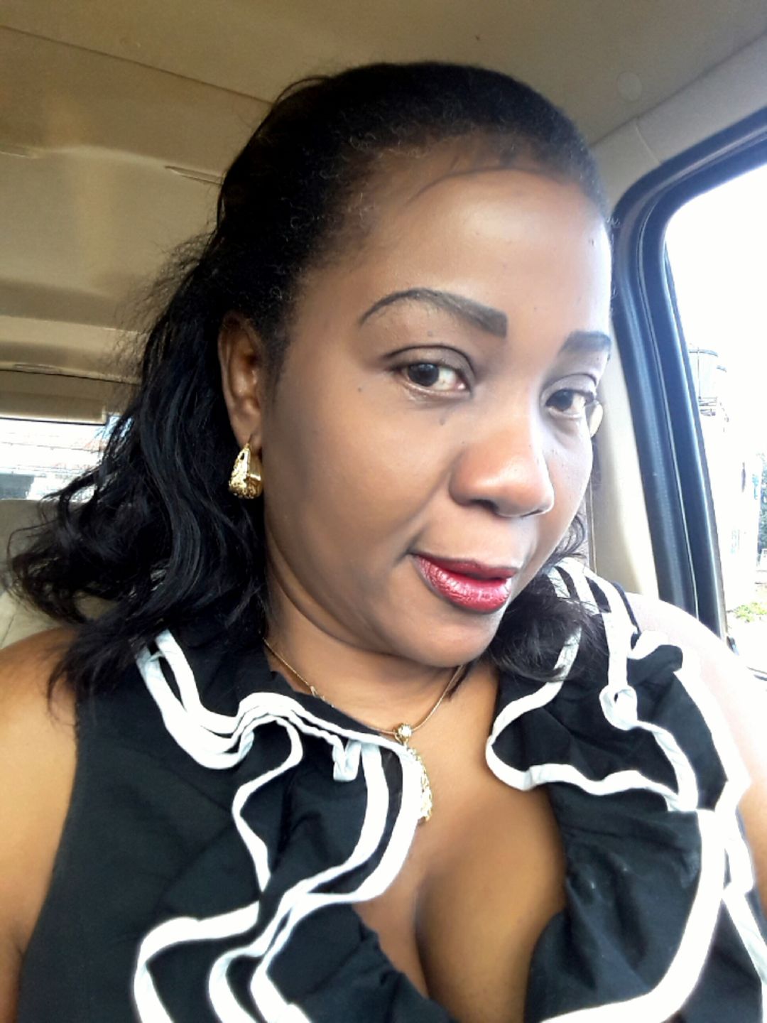 Customer photo review of 10X Cream - Facial Skin Whitening Cream - Tonique
