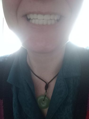 Customer photo review of Teeth-Veneer 2.0