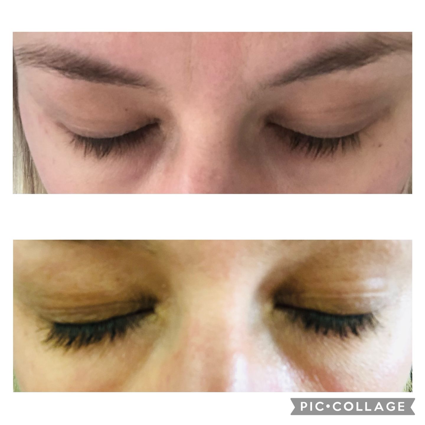 Customer photo review of *PRE-ORDER* Lashes Lash Growth Serum