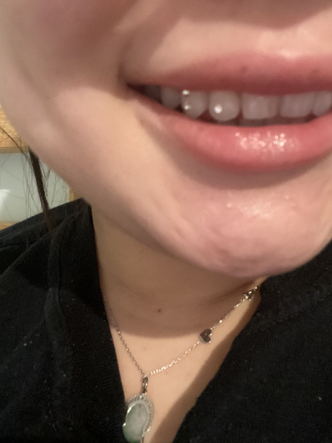 Customer photo review of Crystal Clear 1.8mm 5-pack