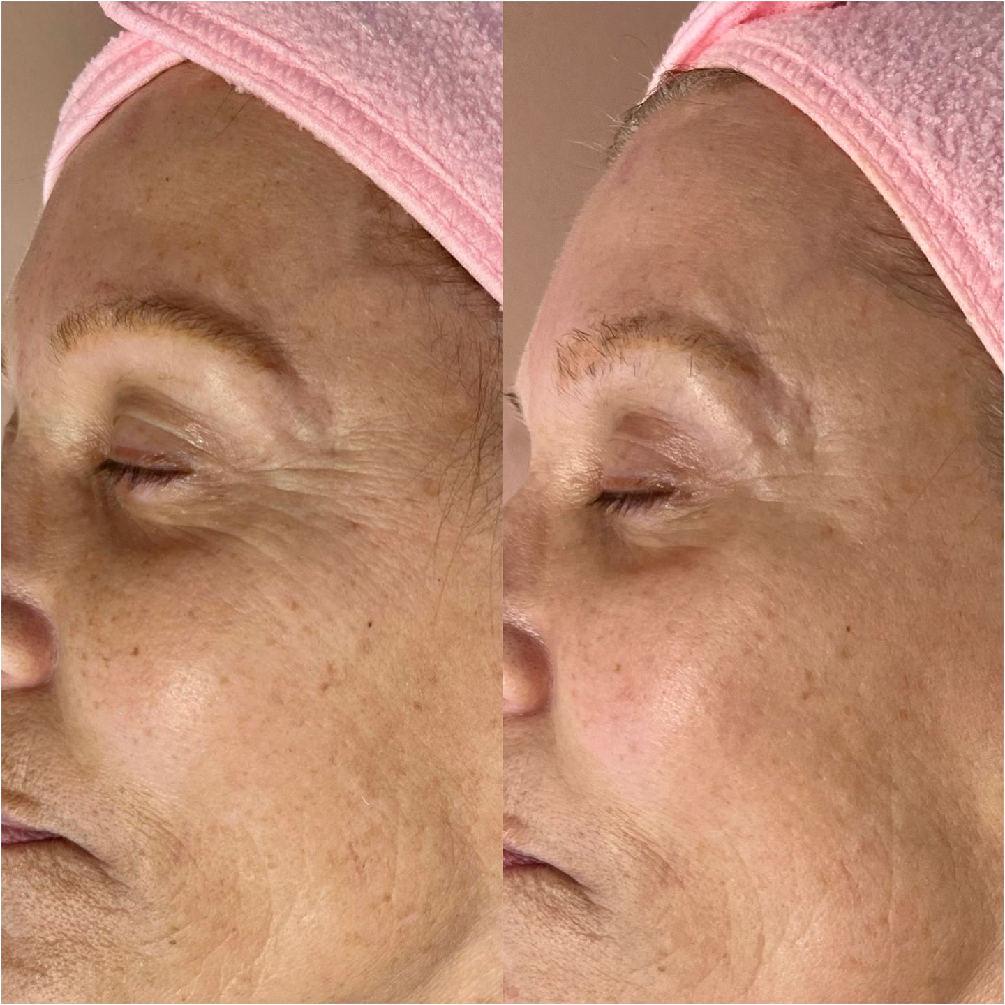 Customer photo review of Zena 100% Organic Algae Peel