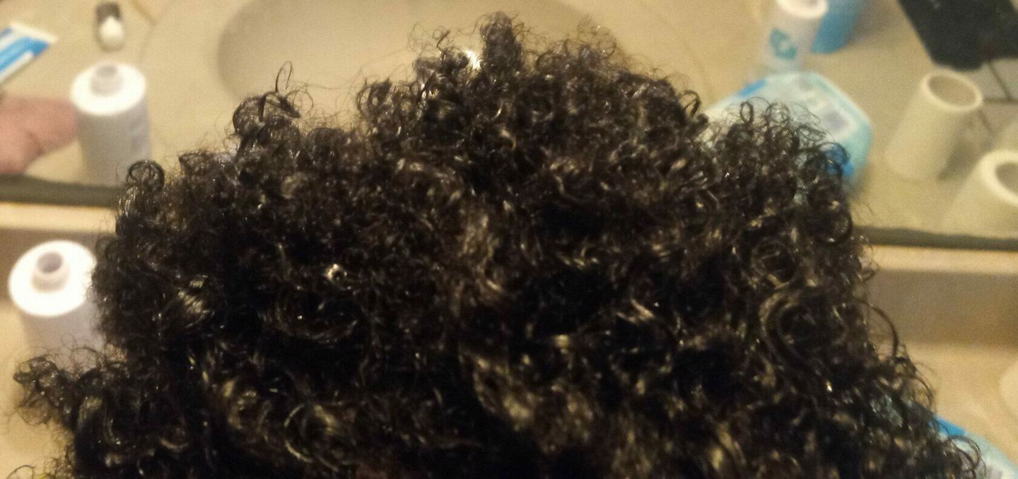 Customer photo review of The Scalp System