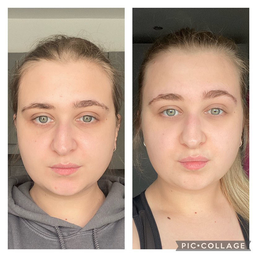 Customer photo review of 90-Day Daily Collagen Powder Bundle