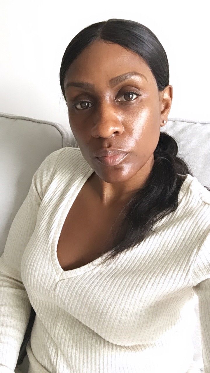 Customer photo review of DAILY C ANTIOXIDANT SERUM