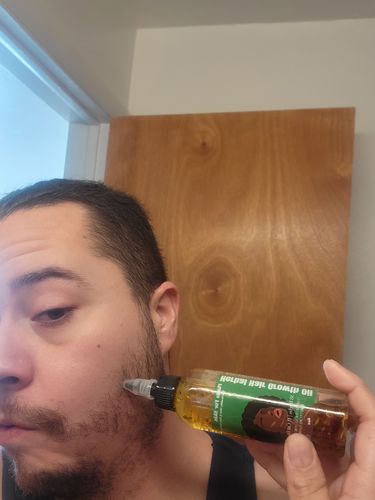 Customer photo review of Herbal Hair/Beard Growth Oil