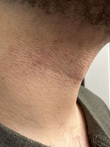 Customer photo review of Aftershave Sensitive