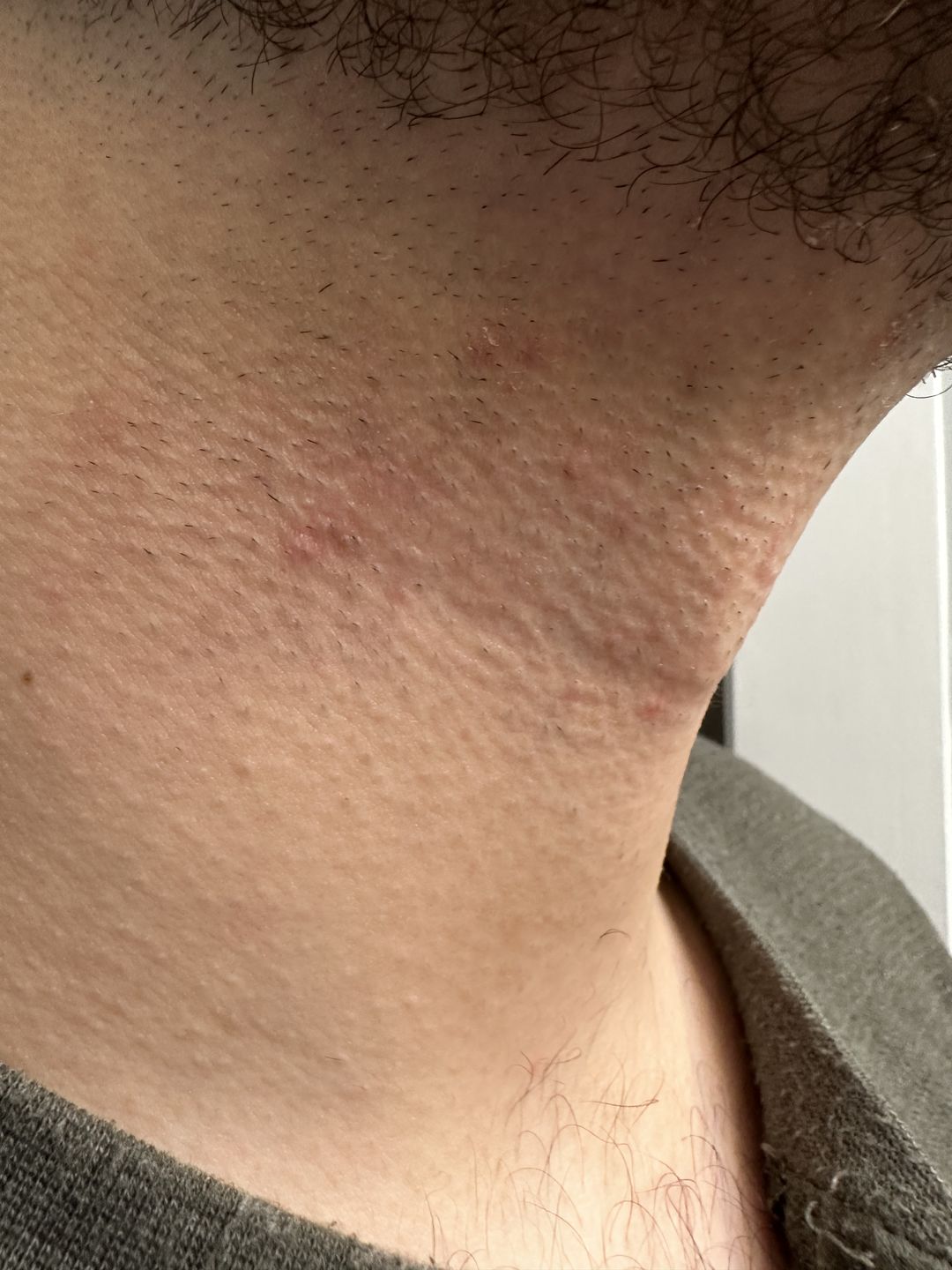 Customer photo review of Aftershave Sensitive