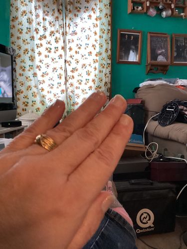 Customer photo review of Rocket Nail Fuel Nail Repair - Clear