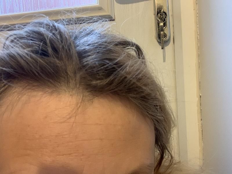 Customer photo review of 90-Day Daily Collagen Powder Bundle