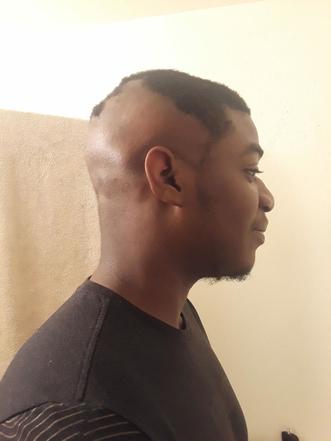 Customer photo review of The Scalp System