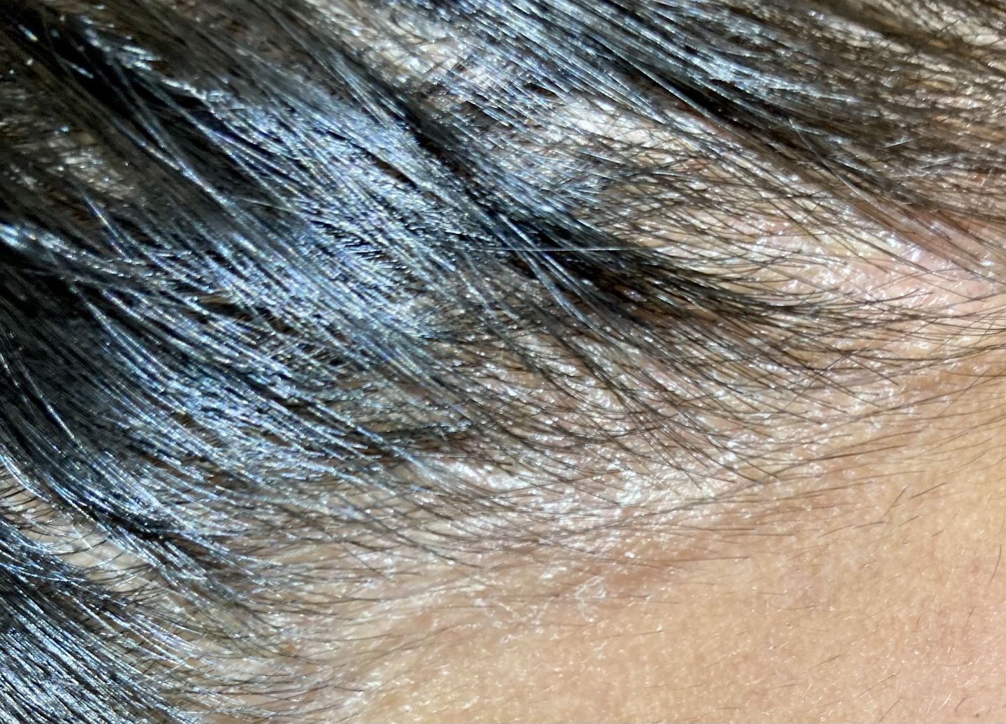 Customer photo review of Shampoo anticaspa en barra