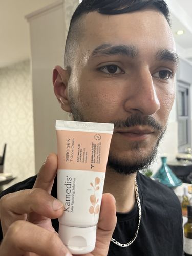 Customer photo review of ערכה טיפולית לעור פנים אדמומי | SEBO T-ZONE KIT