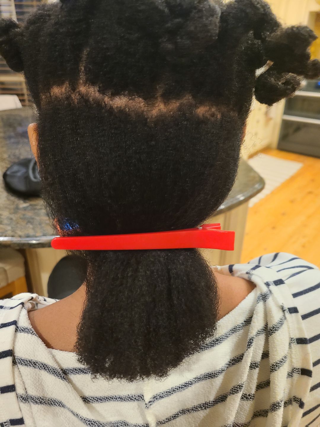 Customer photo review of Hair Recovery Bundle