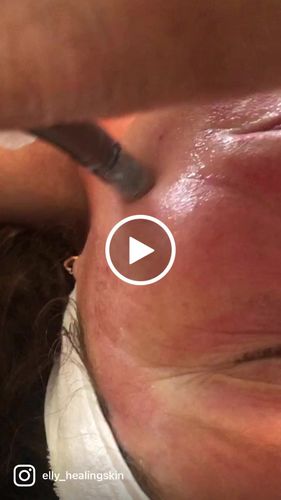 Customer video review of Femvy Peptide Complex Serum