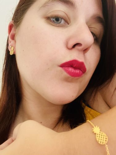 Customer photo review of Little Pineapple Bracelet