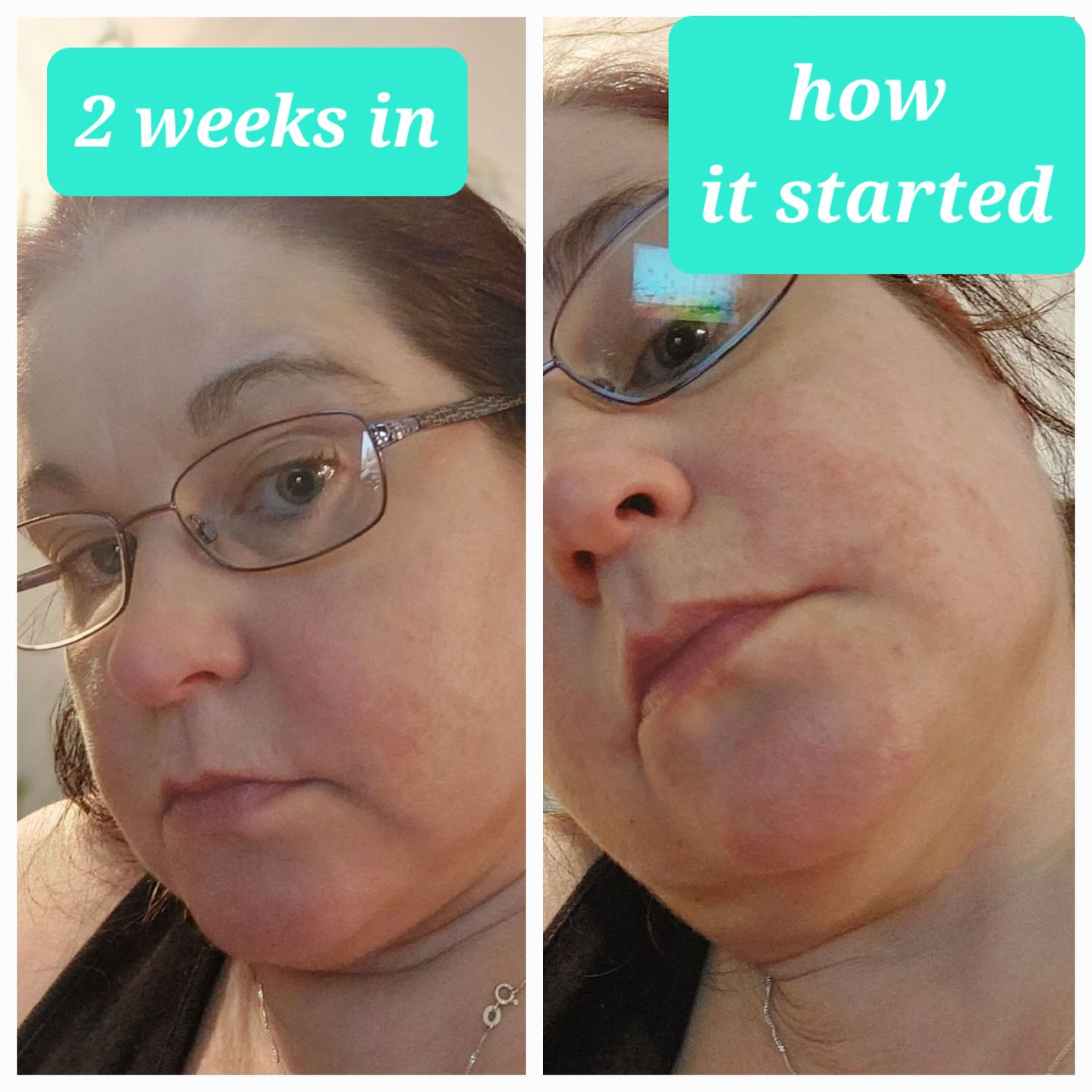 Customer photo review of Rosalique Miracle Brush