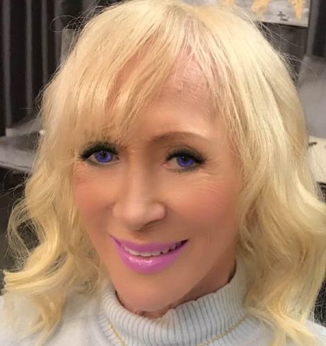 Customer photo review of Hair Topper for Thinning Crown Mono Base Lightest Blonde #60
