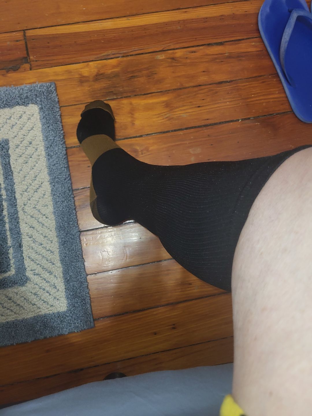 Customer photo review of Copper Compression Socks (3-Pack)